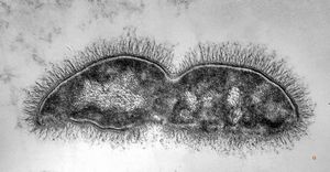 M,35y. | bacilliform microbes in haemoperfusion capsule M,35y. | bacilliform microbes in haemoperfusion capsule